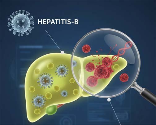 লিভার ক্যানসার